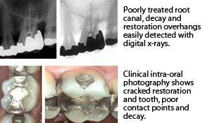 Digital X-Rays and Intra-Oral Photography